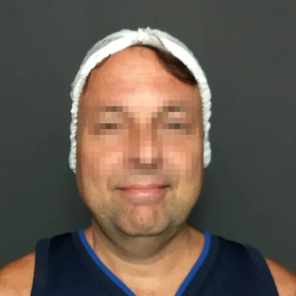 murilo-1-antes