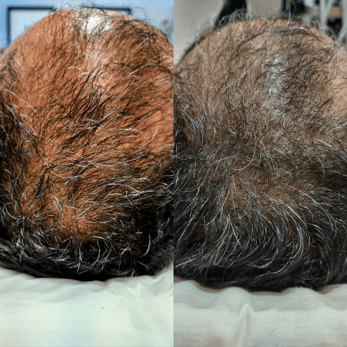 Antes e Depois_01
