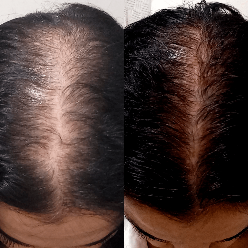 Antes e Depois_02