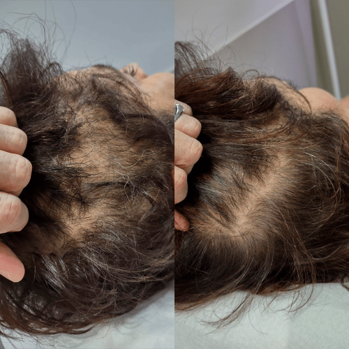 Antes e Depois_03