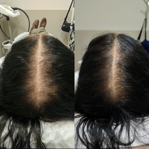 Antes e Depois_04